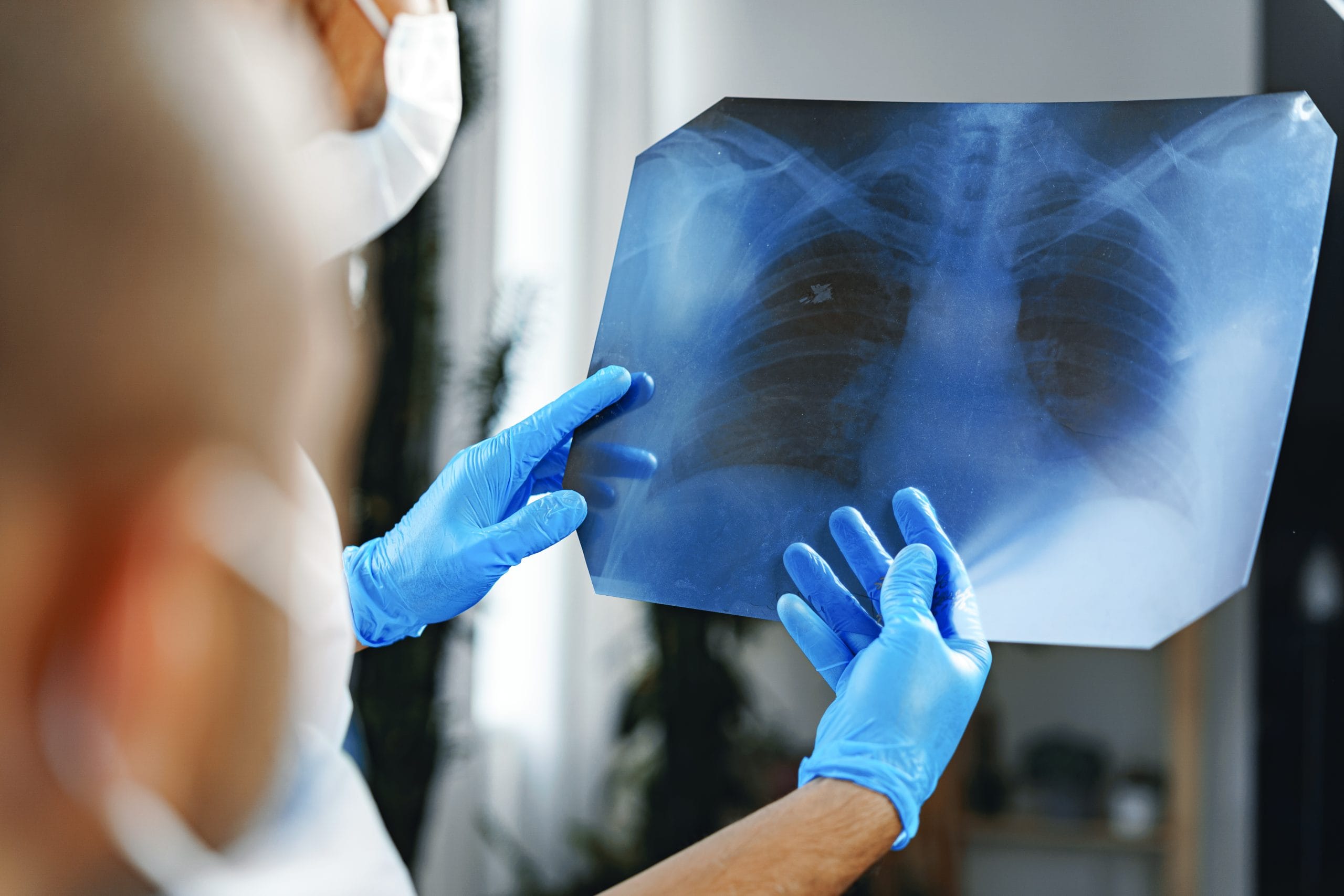 mobile-imaging-is-filling-healthcare-gaps